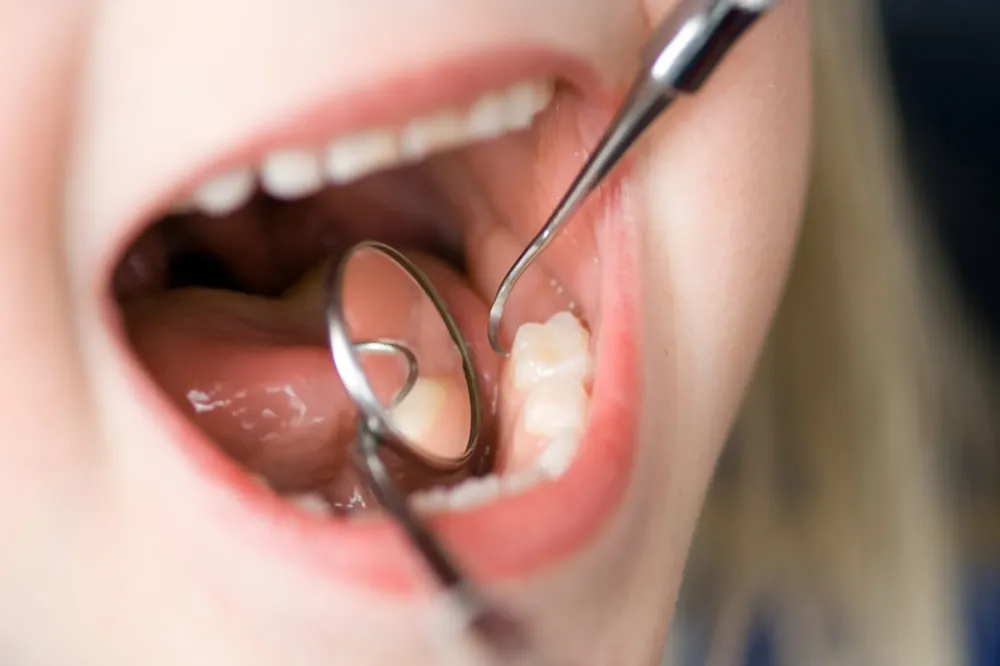 Dentiste enfant